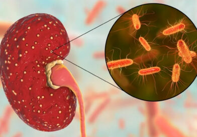 Entra en la recta final de investigación clínica un tratamiento contra el síndrome urémico hemolítico