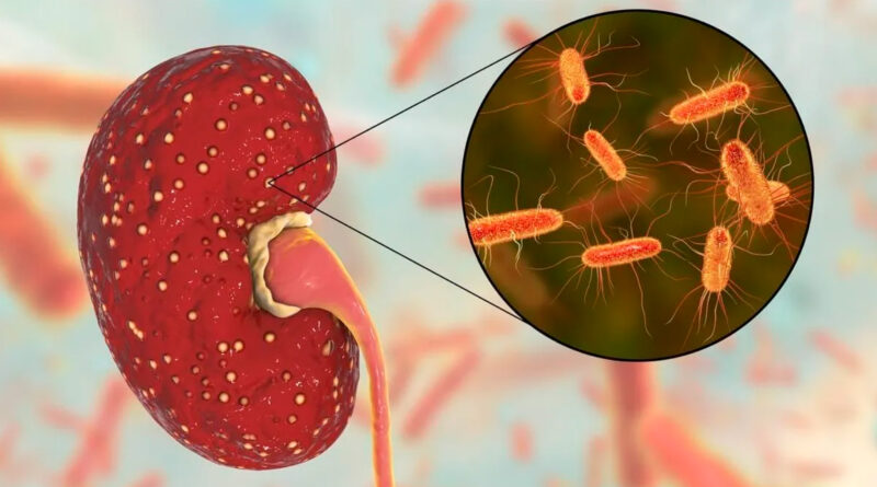 Entra en la recta final de investigación clínica un tratamiento contra el síndrome urémico hemolítico